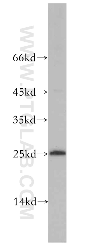 Western Blot (WB) analysis of A549 cells using EIF1AD Polyclonal antibody (20528-1-AP)