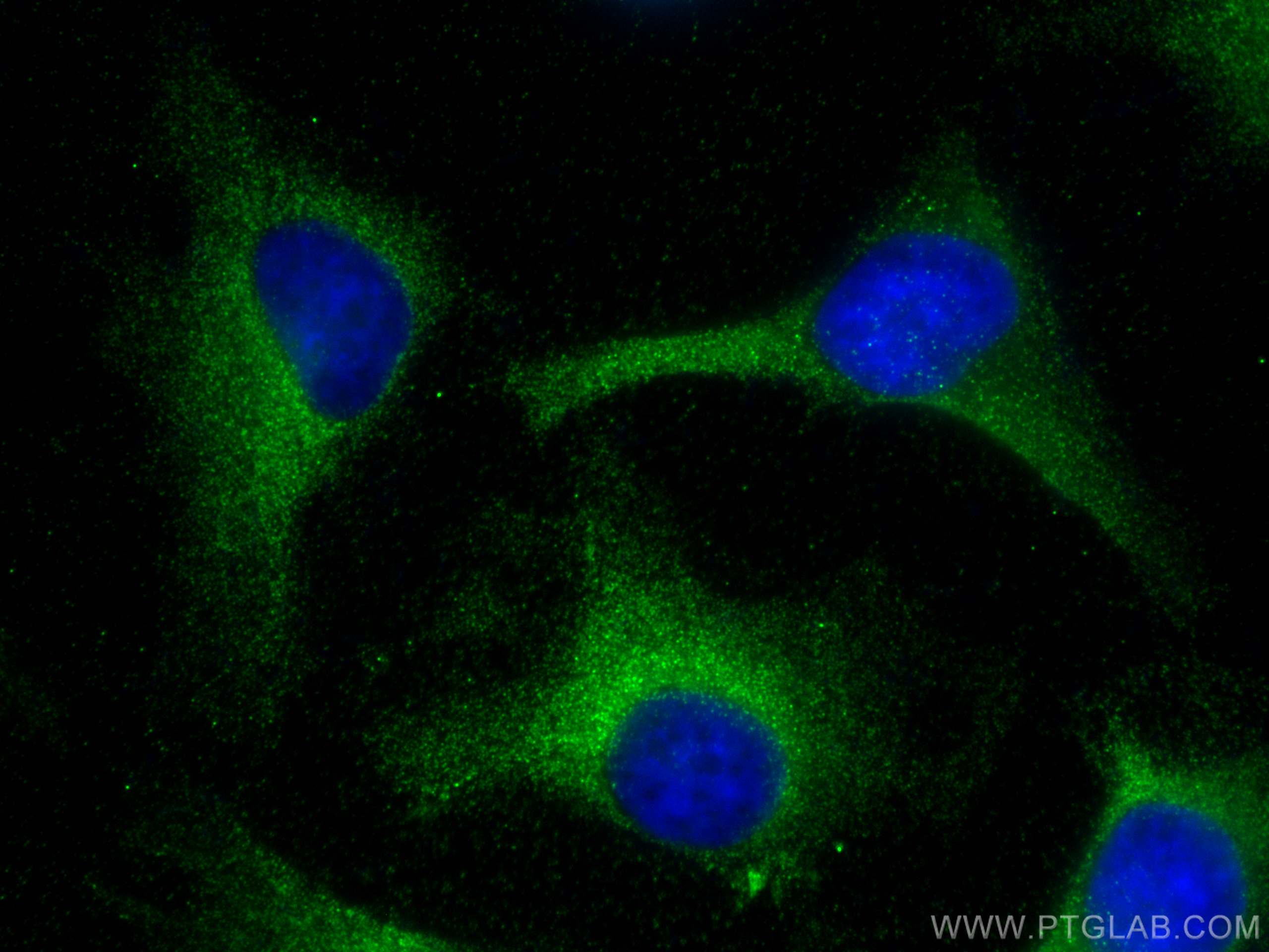 Immunofluorescence (IF) / fluorescent staining of HeLa cells using EIF1AX Polyclonal antibody (11649-2-AP)