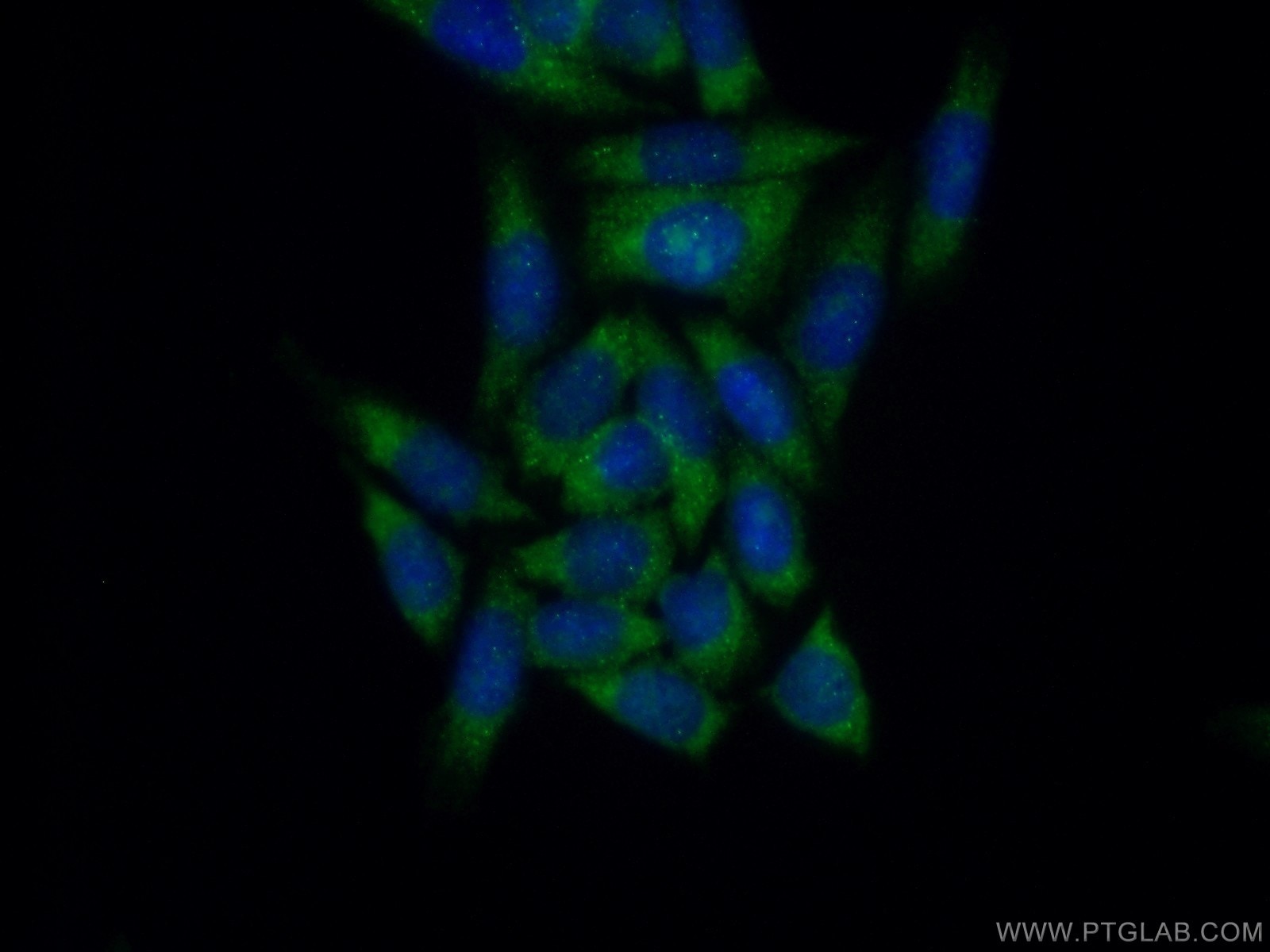 Immunofluorescence (IF) / fluorescent staining of HeLa cells using EIF1AX Polyclonal antibody (11649-2-AP)