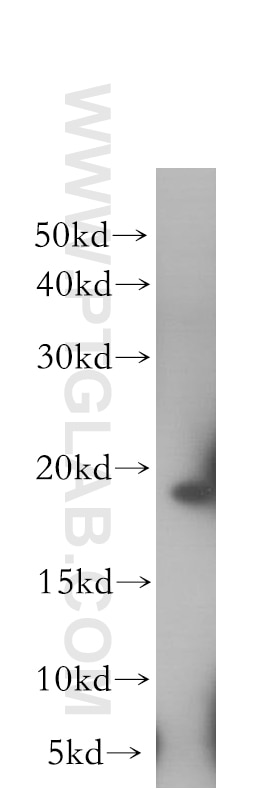 Western Blot (WB) analysis of HeLa cells using EIF1AX Polyclonal antibody (11649-2-AP)