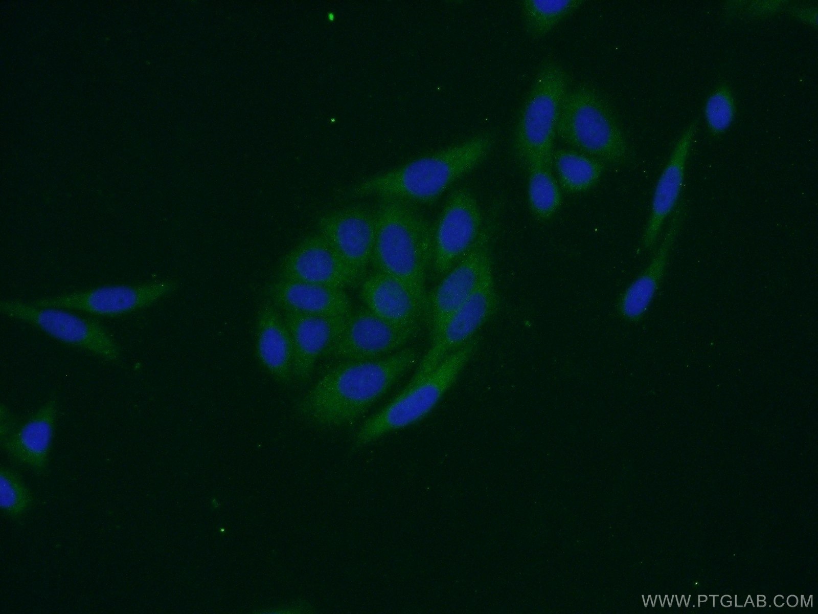 Immunofluorescence (IF) / fluorescent staining of HepG2 cells using EIF1AX Polyclonal antibody (14654-1-AP)