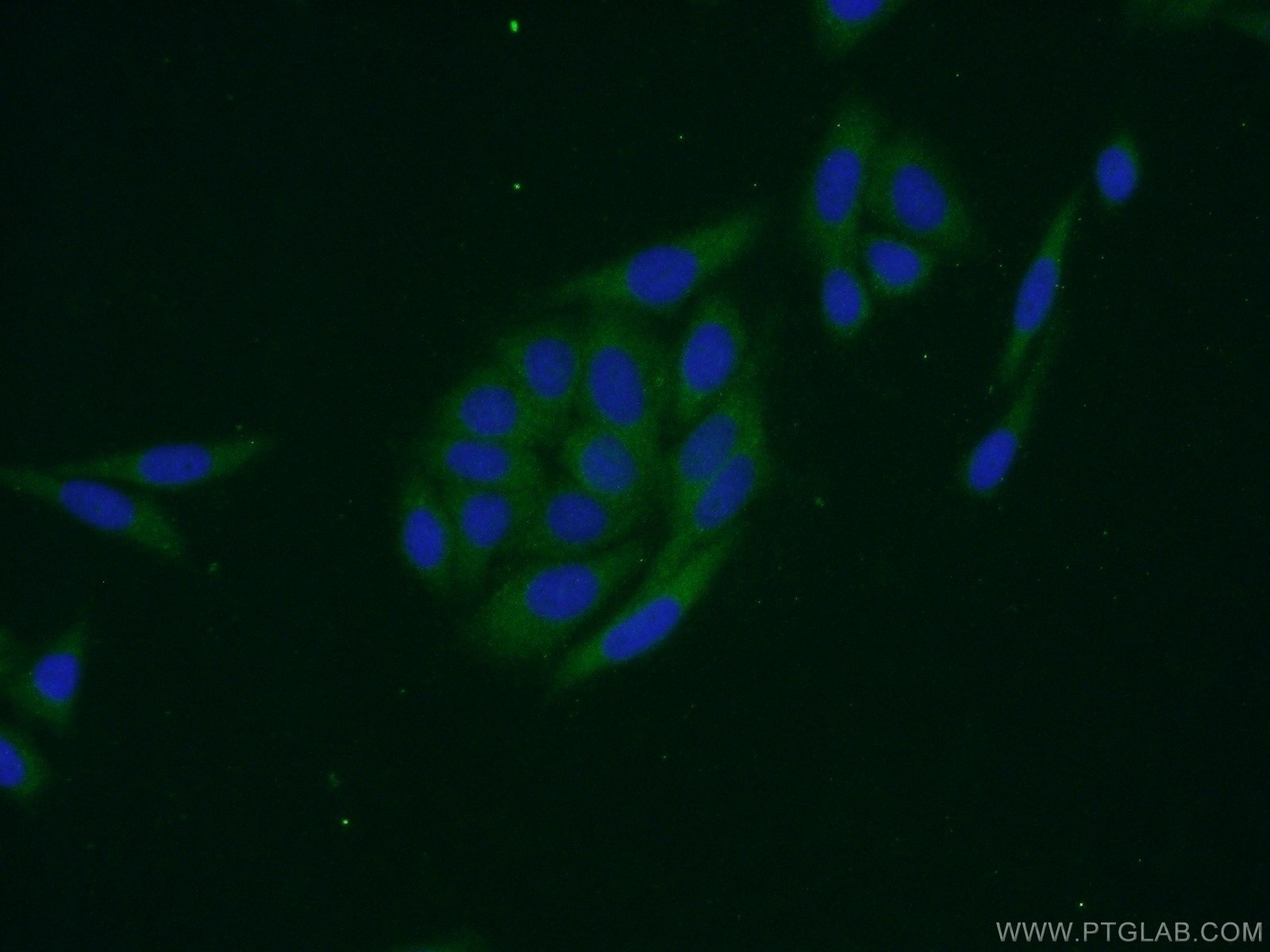 IF Staining of HepG2 using 14654-1-AP