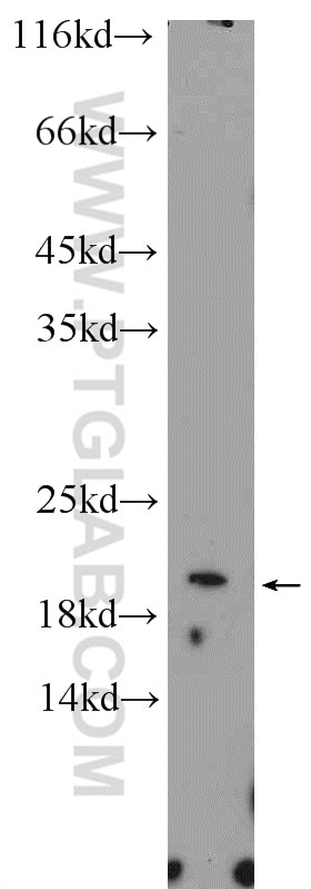 Western Blot (WB) analysis of A375 cells using EIF1AX Polyclonal antibody (14654-1-AP)