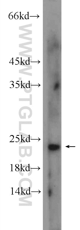 WB analysis of HepG2 using 14654-1-AP