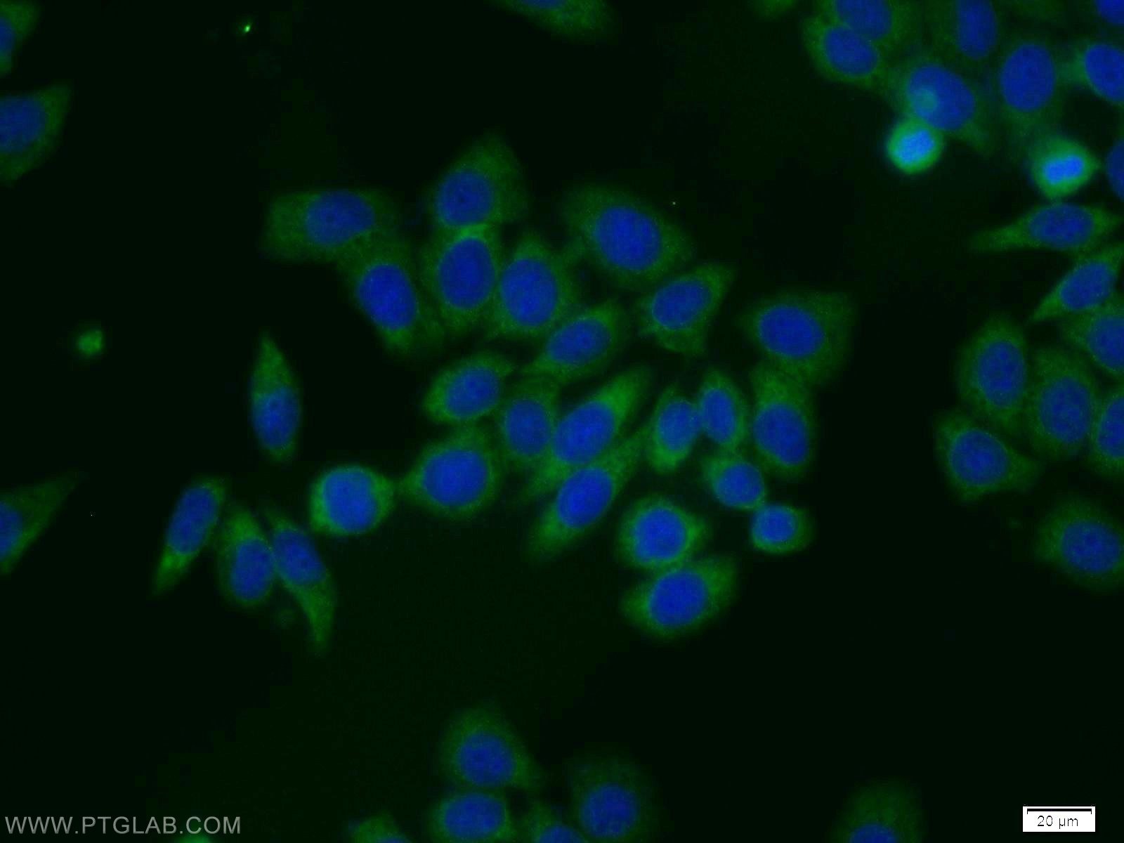 Immunofluorescence (IF) / fluorescent staining of MCF-7 cells using EIF1AY Polyclonal antibody (11193-1-AP)