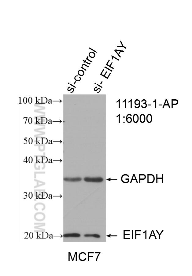 Western Blot (WB) analysis of MCF-7 cells using EIF1AY Polyclonal antibody (11193-1-AP)