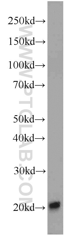 WB analysis of HEK-293 using 11193-1-AP