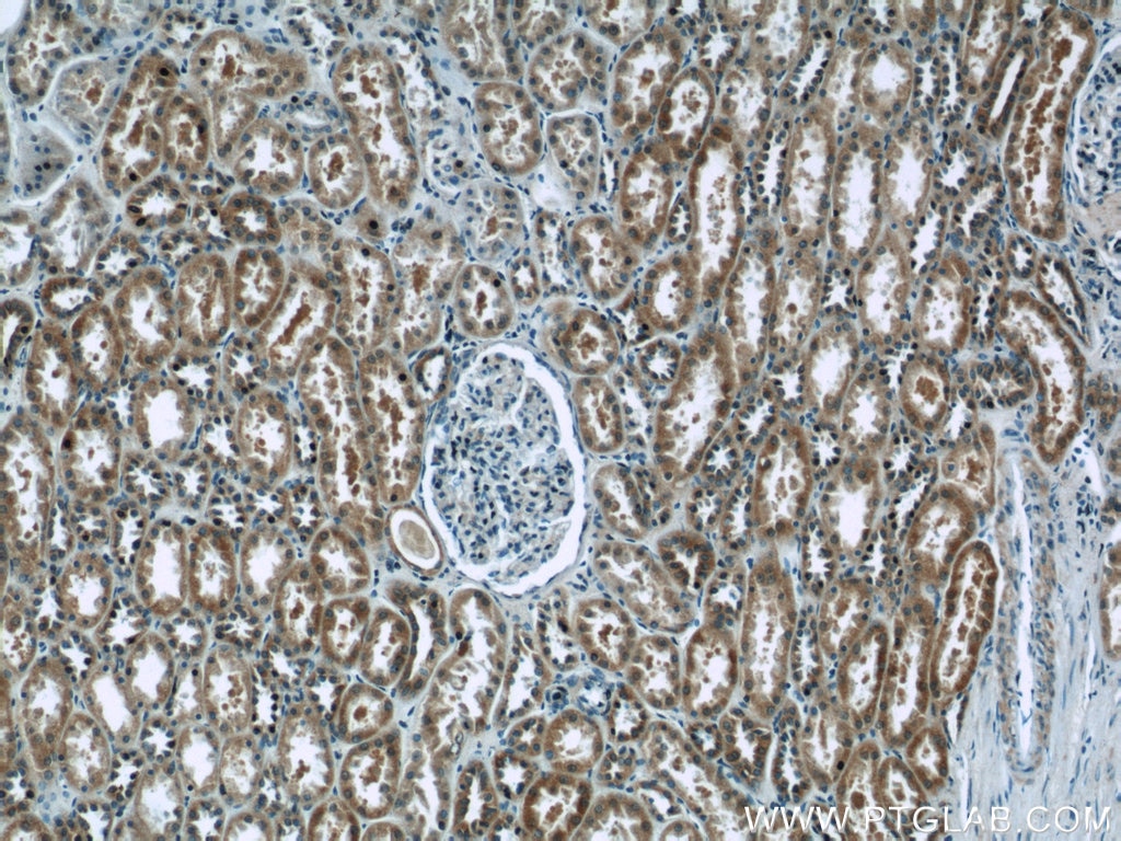 Immunohistochemistry (IHC) staining of human kidney tissue using EIF1, EIF1B Polyclonal antibody (15887-1-AP)