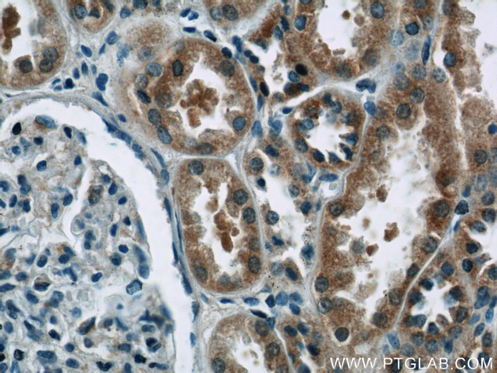 Immunohistochemistry (IHC) staining of human kidney tissue using EIF1, EIF1B Polyclonal antibody (15887-1-AP)
