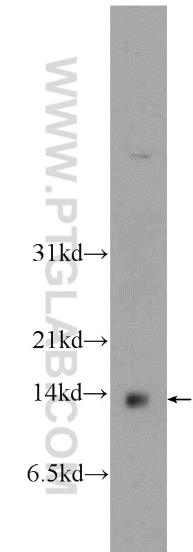 Western Blot (WB) analysis of HeLa cells using EIF1, EIF1B Polyclonal antibody (15887-1-AP)