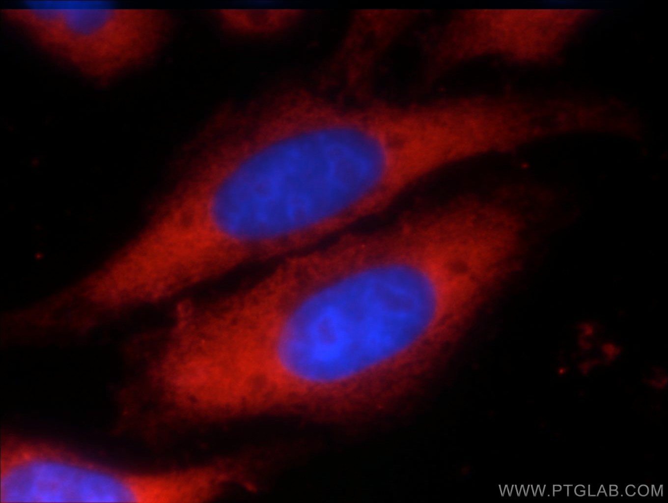 Immunofluorescence (IF) / fluorescent staining of HepG2 cells using EIF2A/CDA02 Polyclonal antibody (11233-1-AP)