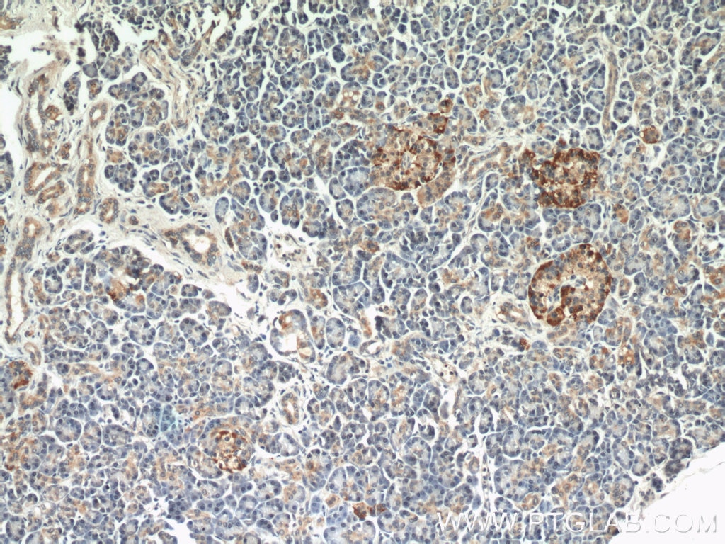 Immunohistochemistry (IHC) staining of human pancreas tissue using EIF2A/CDA02 Polyclonal antibody (11233-1-AP)