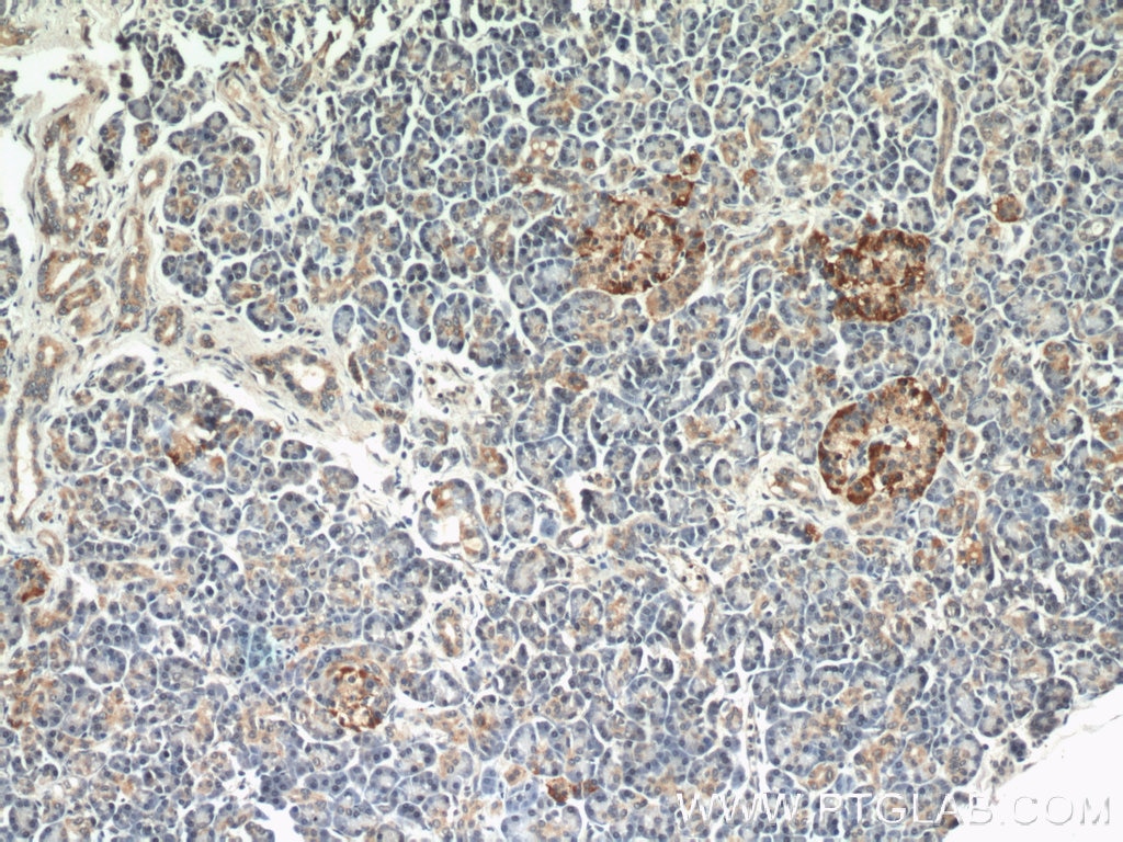 IHC staining of human pancreas using 11233-1-AP