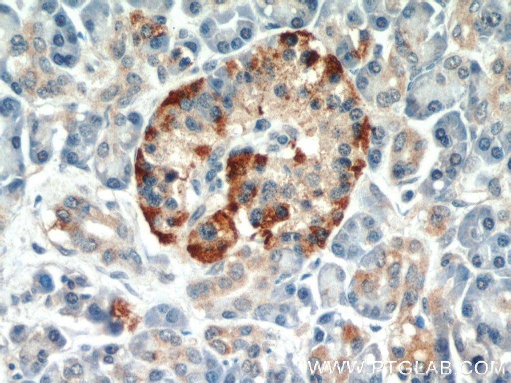 Immunohistochemistry (IHC) staining of human pancreas tissue using EIF2A/CDA02 Polyclonal antibody (11233-1-AP)