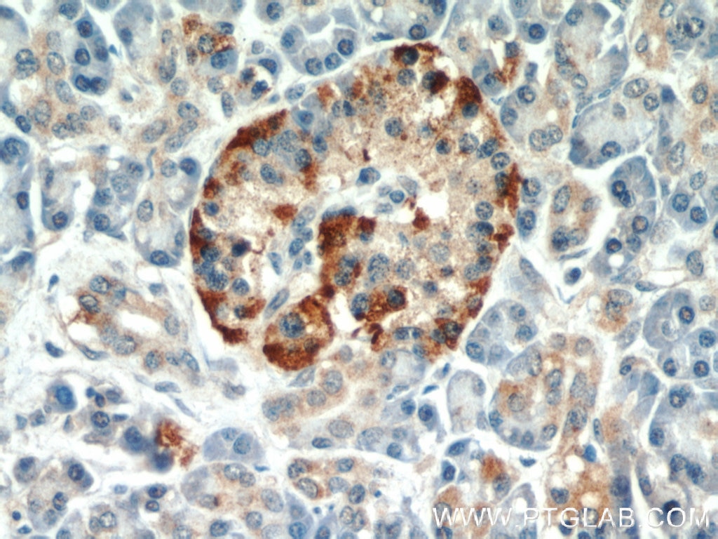 IHC staining of human pancreas using 11233-1-AP