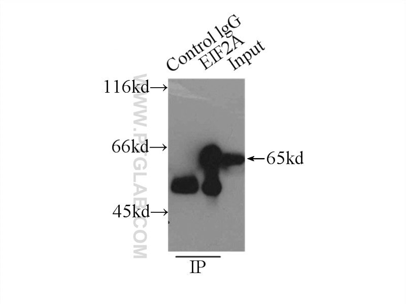 Immunoprecipitation (IP) experiment of MCF-7 cells using EIF2A/CDA02 Polyclonal antibody (11233-1-AP)