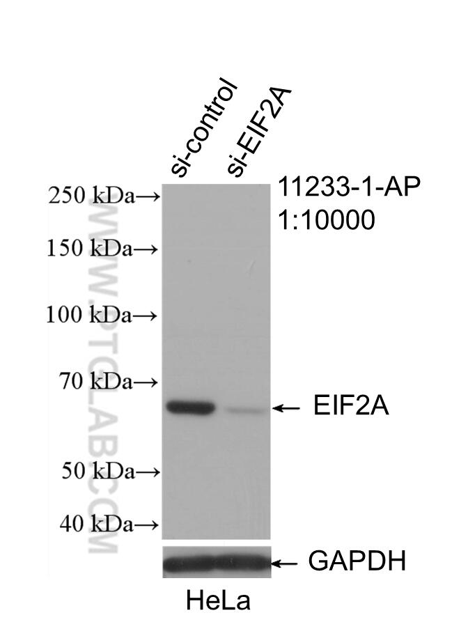 Western Blot (WB) analysis of HeLa cells using EIF2A/CDA02 Polyclonal antibody (11233-1-AP)