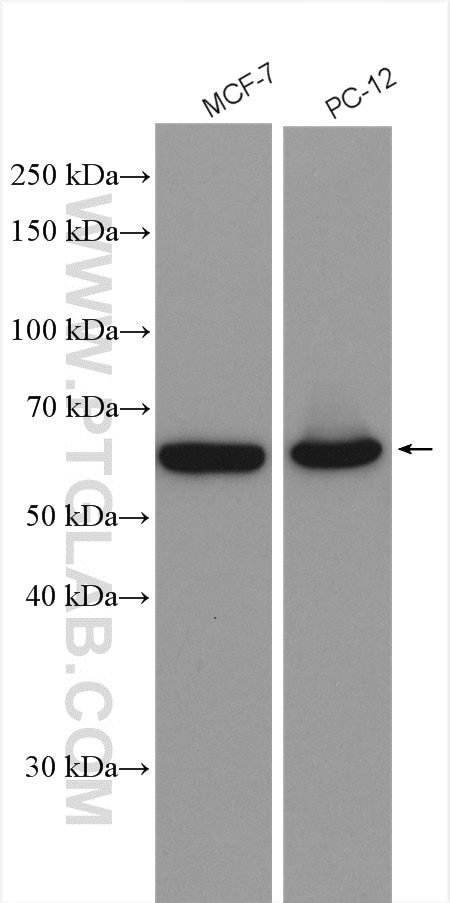 Western Blot (WB) analysis of various lysates using EIF2A/CDA02 Polyclonal antibody (11233-1-AP)