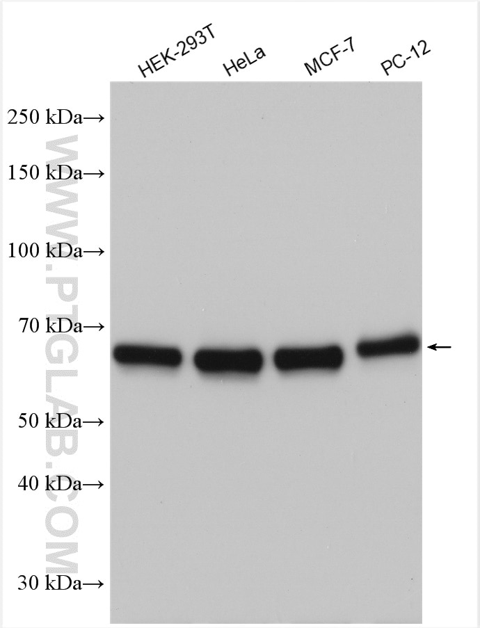 Western Blot (WB) analysis of various lysates using EIF2A/CDA02 Polyclonal antibody (11233-1-AP)
