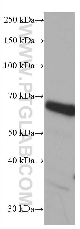 Western Blot (WB) analysis of HeLa cells using EIF2A/CDA02 Monoclonal antibody (66482-1-Ig)