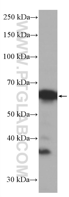 Western Blot (WB) analysis of HEK-293 cells using EIF2A/CDA02 Monoclonal antibody (66482-1-Ig)