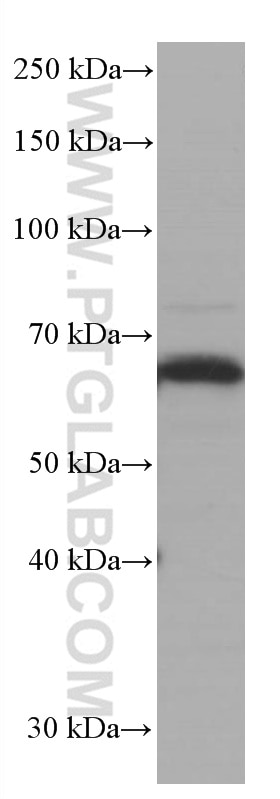 Western Blot (WB) analysis of ROS1728 cells using EIF2A/CDA02 Monoclonal antibody (66482-1-Ig)