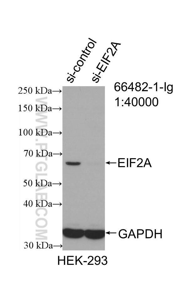 Western Blot (WB) analysis of HEK-293 cells using EIF2A/CDA02 Monoclonal antibody (66482-1-Ig)