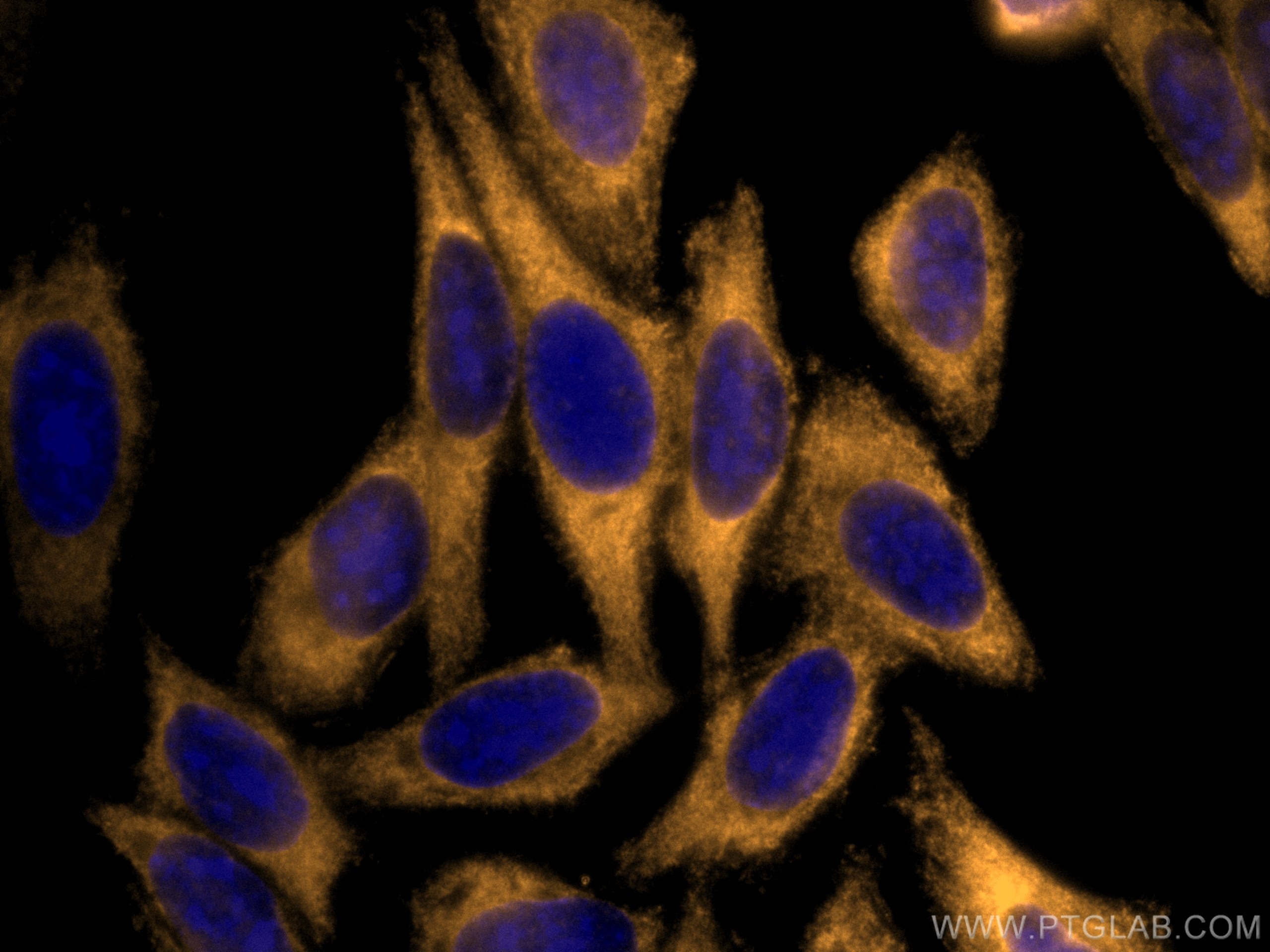 Immunofluorescence (IF) / fluorescent staining of HepG2 cells using CoraLite®555-conjugated EIF2A/CDA02 Monoclonal ant (CL555-66482)