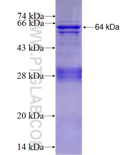 EIF2A fusion protein Ag1753 SDS-PAGE