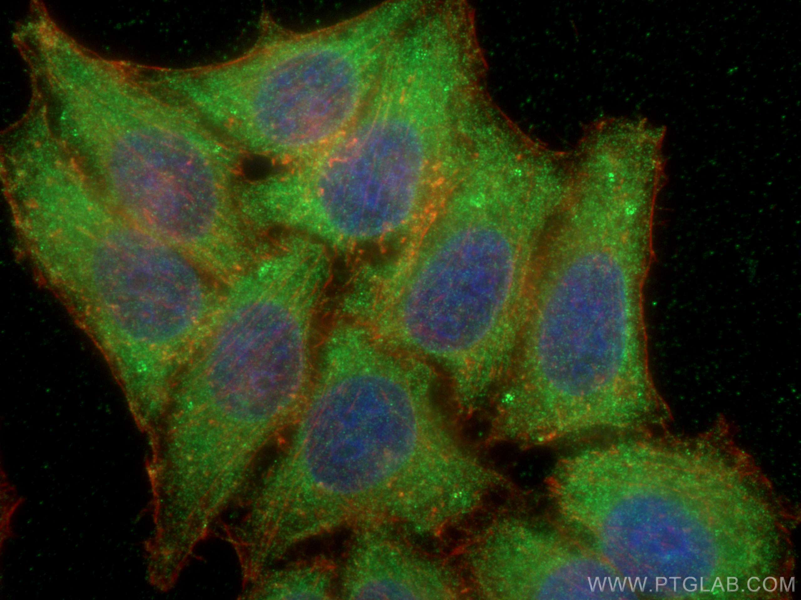 Immunofluorescence (IF) / fluorescent staining of HepG2 cells using EIF2AK1 Polyclonal antibody (20499-1-AP)