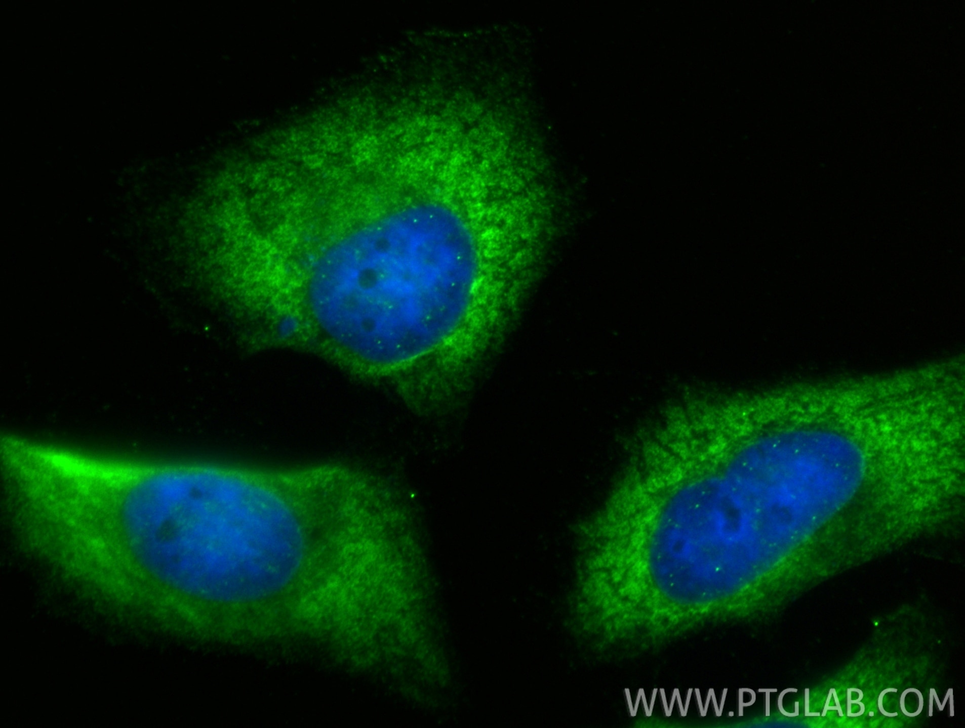 Immunofluorescence (IF) / fluorescent staining of HeLa cells using EIF2AK1 Polyclonal antibody (20499-1-AP)