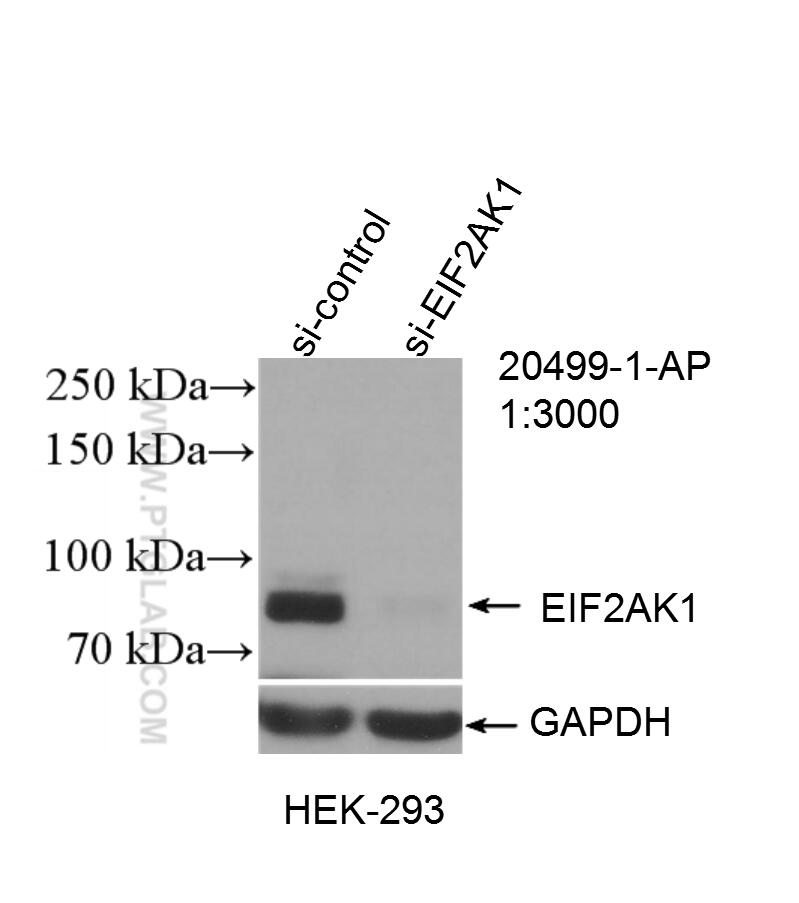 Western Blot (WB) analysis of HEK-293 cells using EIF2AK1 Polyclonal antibody (20499-1-AP)