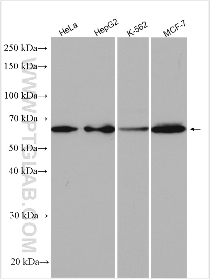 Western Blot (WB) analysis of various lysates using EIF2AK1 Polyclonal antibody (20499-1-AP)