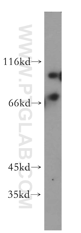 Western Blot (WB) analysis of HepG2 cells using EIF2AK1 Polyclonal antibody (20499-1-AP)
