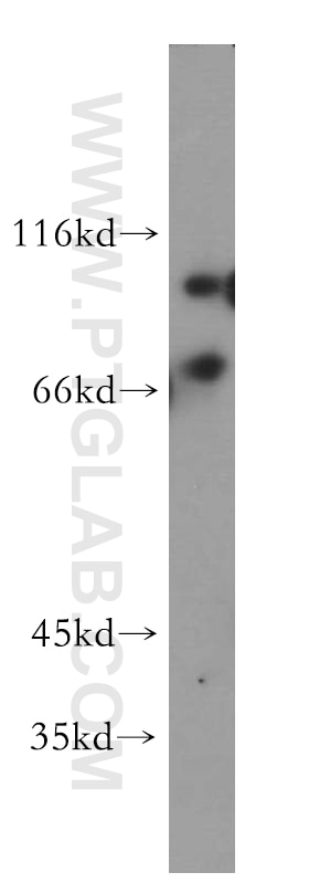 WB analysis of HepG2 using 20499-1-AP