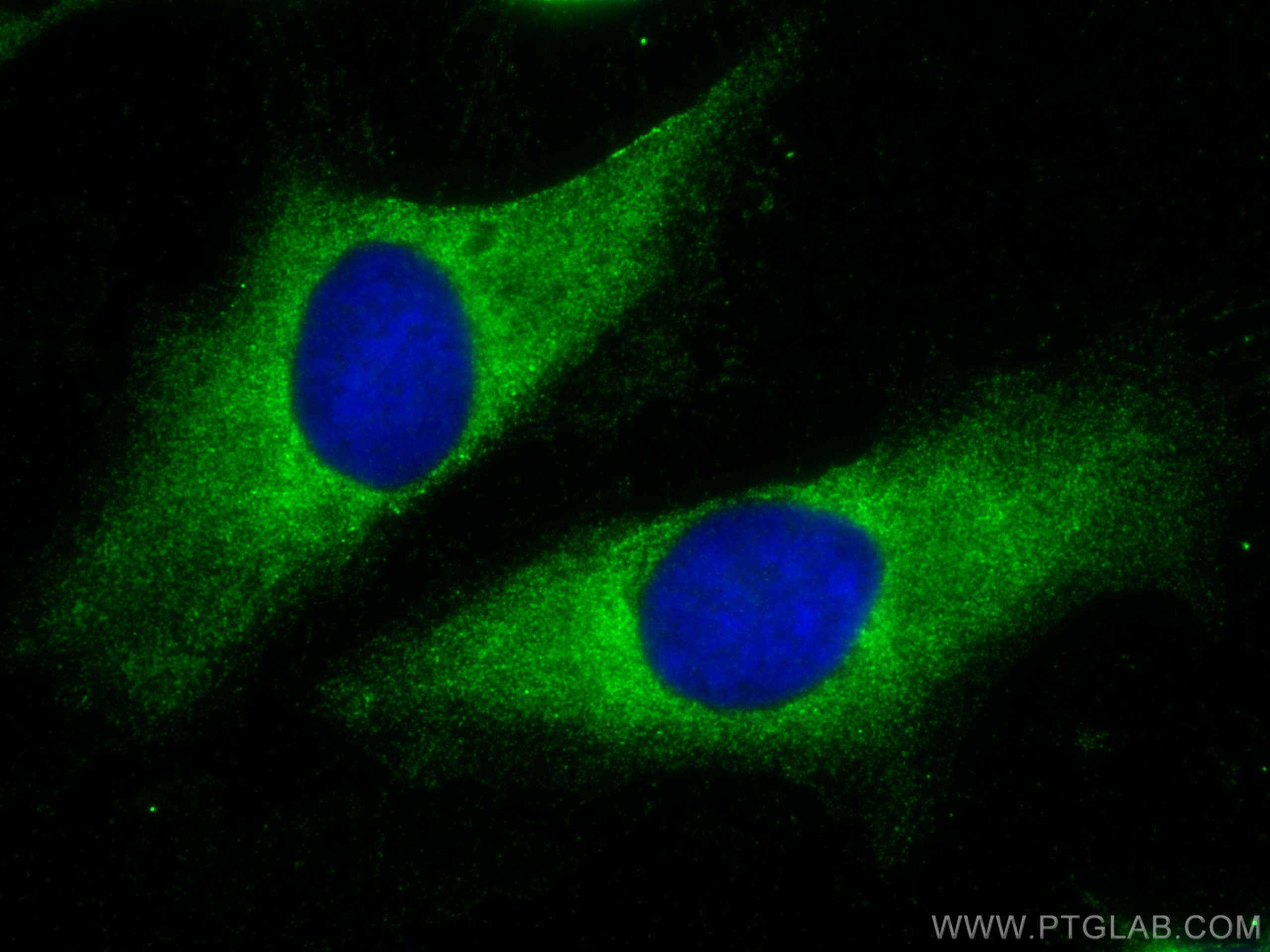 Immunofluorescence (IF) / fluorescent staining of HeLa cells using EIF2AK1 Monoclonal antibody (67674-1-Ig)