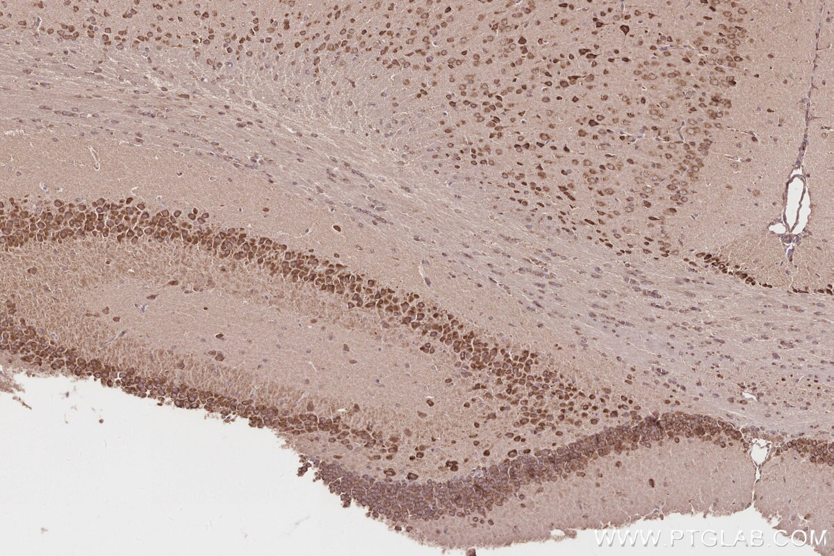 Immunohistochemistry (IHC) staining of mouse brain tissue using EIF2AK1 Monoclonal antibody (67674-1-Ig)