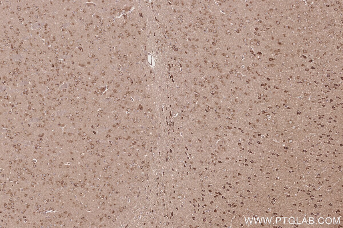 Immunohistochemistry (IHC) staining of mouse brain tissue using EIF2AK1 Monoclonal antibody (67674-1-Ig)
