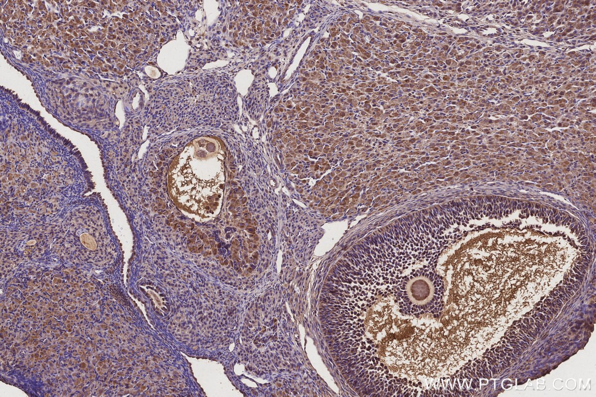 Immunohistochemistry (IHC) staining of rat ovary tissue using EIF2AK1 Monoclonal antibody (67674-1-Ig)
