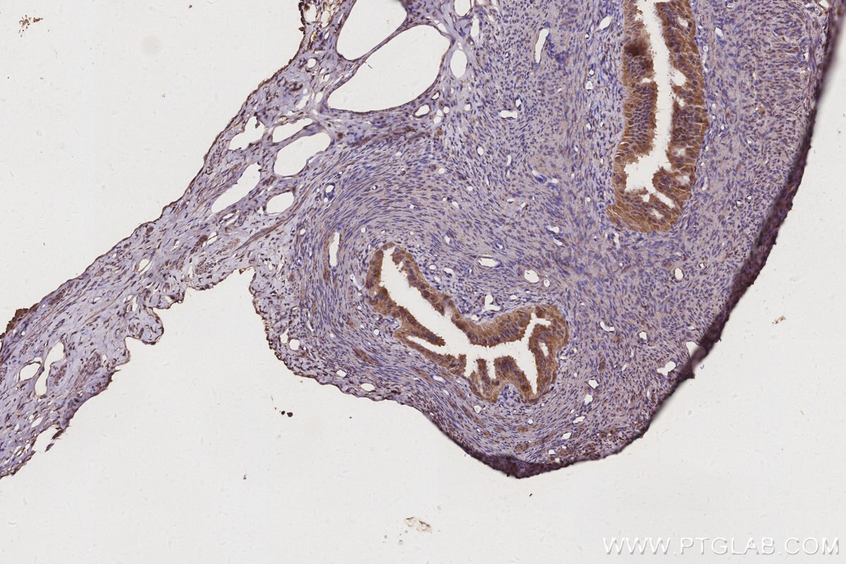 Immunohistochemistry (IHC) staining of rat ovary tissue using EIF2AK1 Monoclonal antibody (67674-1-Ig)