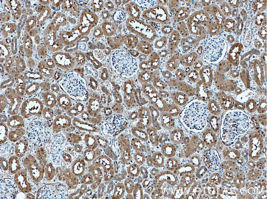 Immunohistochemistry (IHC) staining of human kidney tissue using EIF2AK2, PKR Polyclonal antibody (18244-1-AP)