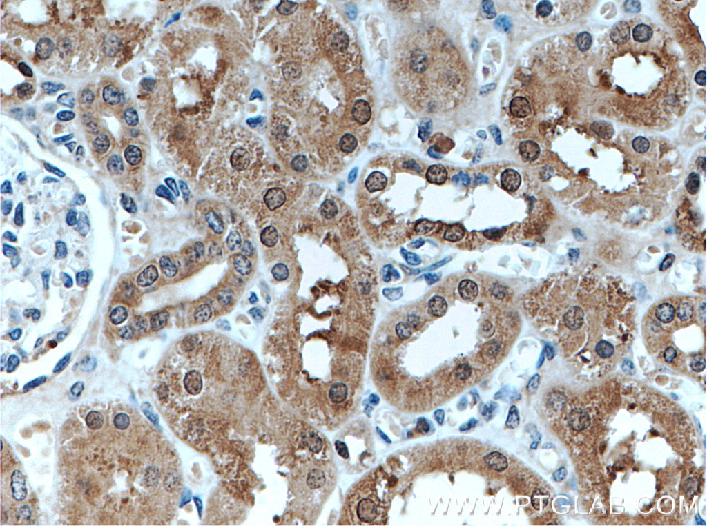 Immunohistochemistry (IHC) staining of human kidney tissue using EIF2AK2, PKR Polyclonal antibody (18244-1-AP)