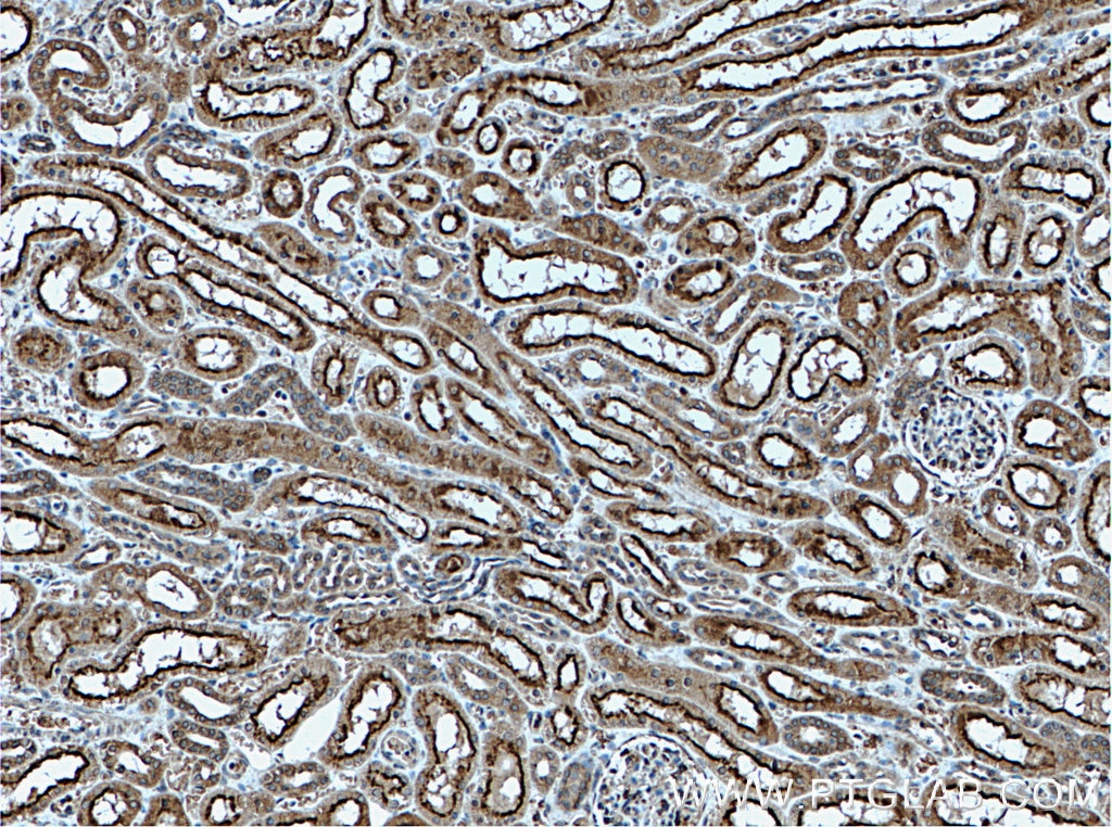 Immunohistochemistry (IHC) staining of human kidney tissue using EIF2AK2, PKR Polyclonal antibody (18244-1-AP)