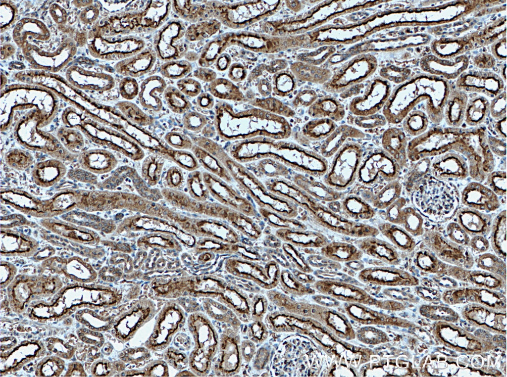 IHC staining of human kidney using 18244-1-AP