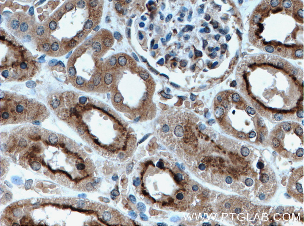 Immunohistochemistry (IHC) staining of human kidney tissue using EIF2AK2, PKR Polyclonal antibody (18244-1-AP)