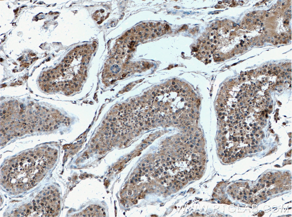 Immunohistochemistry (IHC) staining of human testis tissue using EIF2AK2, PKR Polyclonal antibody (18244-1-AP)