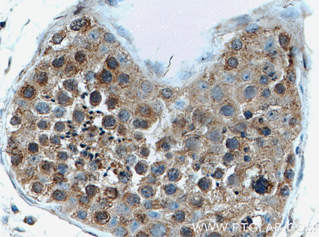 Immunohistochemistry (IHC) staining of human testis tissue using EIF2AK2, PKR Polyclonal antibody (18244-1-AP)