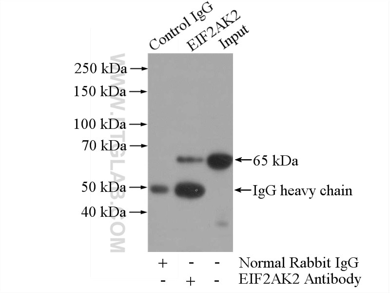 Immunoprecipitation (IP) experiment of HeLa cells using EIF2AK2, PKR Polyclonal antibody (18244-1-AP)