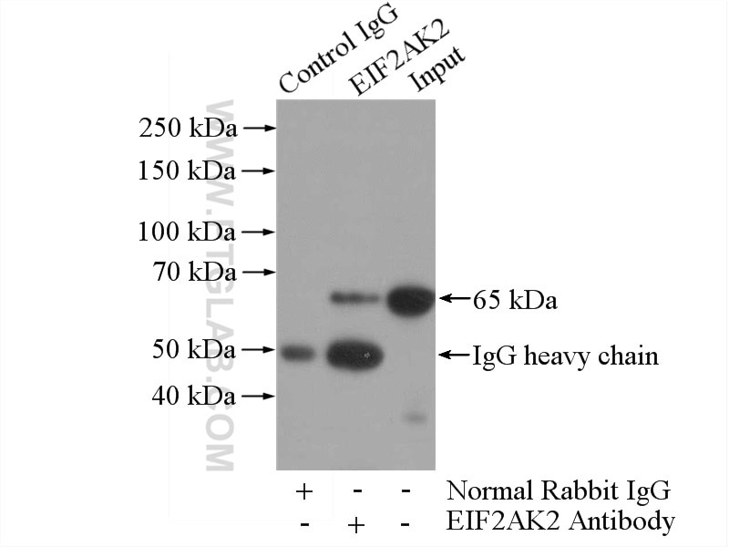 IP experiment of HeLa using 18244-1-AP