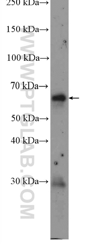 Western Blot (WB) analysis of mouse thymus tissue using EIF2AK2, PKR Polyclonal antibody (18244-1-AP)